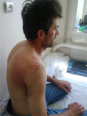 Магомед Арчаков. Фото "Кавказского Узла" Магомед Арчаков. Фото "Кавказского Узла"