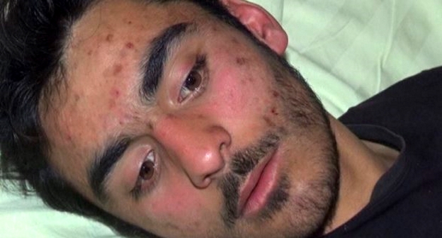 Пострадавший Радиль Мирзаев. Фото:
Report.az/ru/proisshestviya/v-azerbajdzhane-pohishennyj-neizvestnymi-v-maskah-molodoj-chelovek-najden-v-bessoznatel-nom-sostoyanii