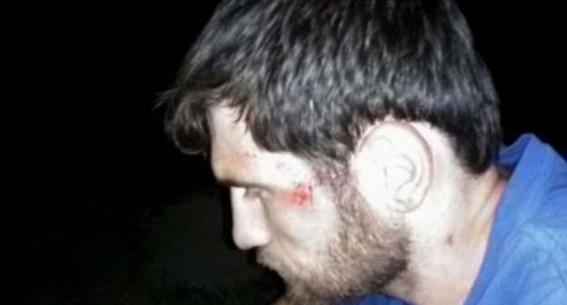 Побои на лице у дальнобойщика Рустама Малламагомедова. 23 августа 2016 г. Фото Елены Филипповой https://www.facebook.com/photo.php?fbid=1562448027396598&set=ecnf.100008942464217&type=3&theater