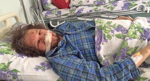 Андрей Рудомаха после нападения. Фото предоставлено "Кавказскому узлу" Михаилом Абрамяном