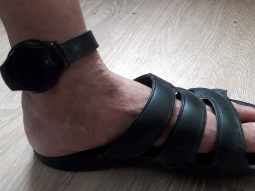 Электронный браслет на ноге Николая Кузичкина. Фото предоставлено "Кавказскому узлу" супругой Кузичкина.