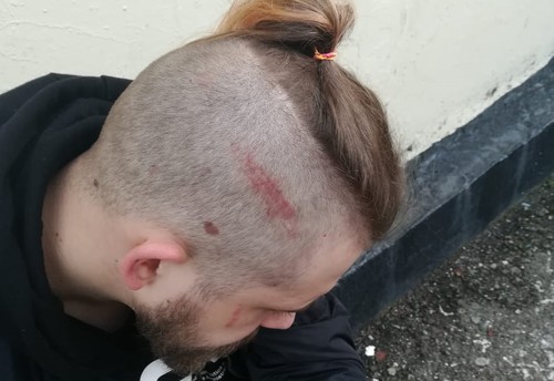 Полуян со шрамом на голове,23 января 2021 года. Фото Алексея Челмакина.