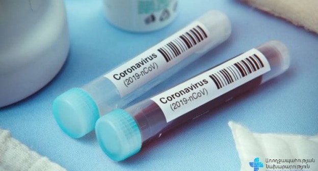 Анализ крови  на COVID-19. Фото пресс-службы Минздрава Армении. https://www.facebook.com/ministryofhealthcare/