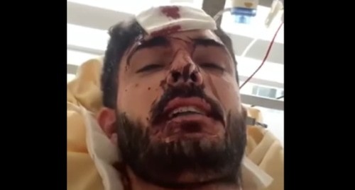Мухаммед Мирзали после нападения. Стоп кадр видео канала  Amon Equalizer   https://www.youtube.com/watch?v=nVEhi45e3vg