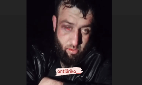 Мужчина с гематомами на видео "Антилирики". Стоп-кадр видео от 08.01.24 из telegram-канала https://t.me/ing_antilirika/39