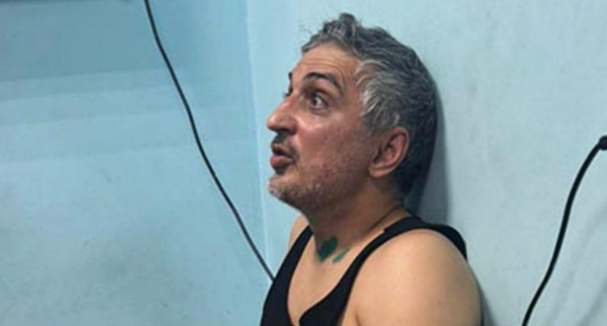 Заур Кайтуев после избиения. Фото предоставлено "Кавказскому узлу".